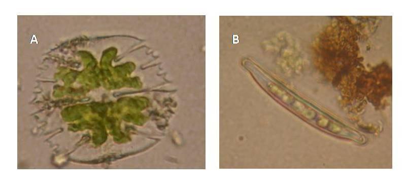 Figura 03 Ilustrações de microalgas perifíticas ocorrentes no açude Thomaz O. Alencar. Micrasterias truncata (A), Eunotia sp. (B). Fonte: Fotos dos autores.