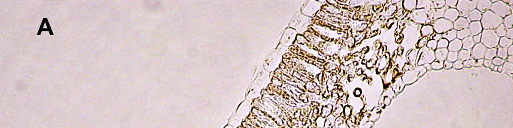 Figura 28 Corte transversal do mesófilo de uma folha adulta de Vitis vinifera subsp. vinifera revelando a existência de drusas.