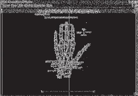 Desenvolvimento de um programa computacional para implementação do método de leitura de idade óssea de Tanner e Whitehouse Figura 1.