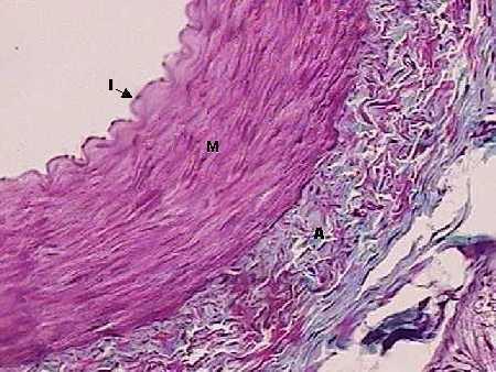 ARTÉRIAS DE MÉDIO CALIBRE São artérias musculares constituídas pela túnica íntima, média e adventícia.