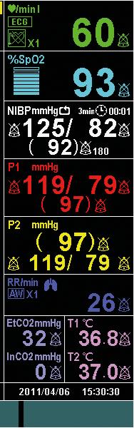 1 1 INDICAÇÃO DE DERIVAÇÃO ECG 2 2 Oxímetro de pulso SpO 2 NELLCOR OXIMAX SENSOR 3 3 NIBP (MNIPA)