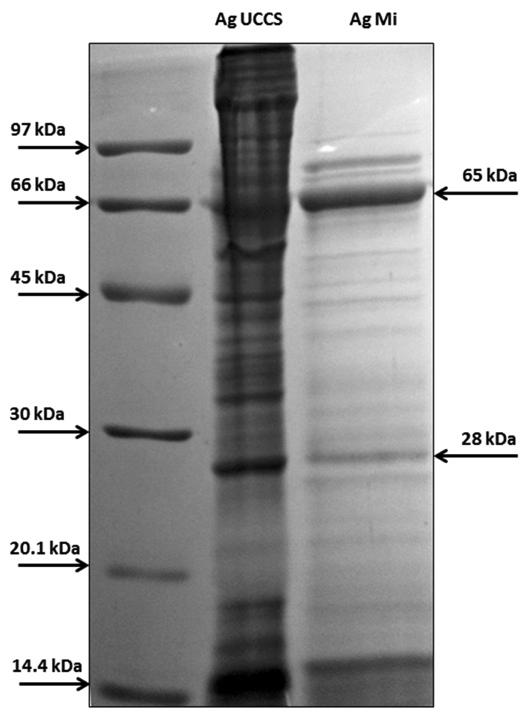 3.2 SDS-PAGE e Western Blot O padrão eletroforético apresentado pelas proteínas do AgMi, mostra um modelo de bandas com pesos moleculares aproximados de 14,4 a 97 kda, como pode ser representado na