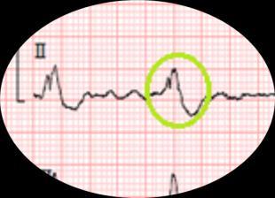 Quais os dados que esperaria encontrar na telerradiografia do tórax?