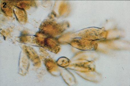 Protozoários