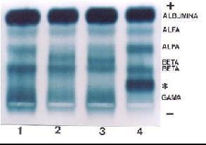 RNA e