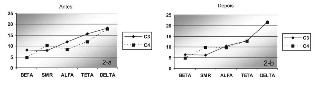 Figura 2 (a e b) Comparação entre o hemisfério esquerdo (C3) e o hemisfério direito (C4) por onda cerebral, antes e depois do treinamento apenas com o grupo hemisférico direito (HD) necessite de um