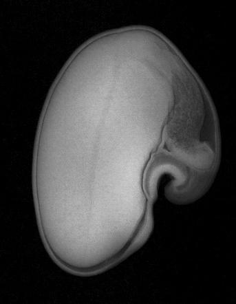 30 Figura 2.9 Imagem radiográfica de semente de Crotalaria juncea do cv. IAC-KR1 (a), apresentando dano por percevejo no eixo embrionário (nota 3.