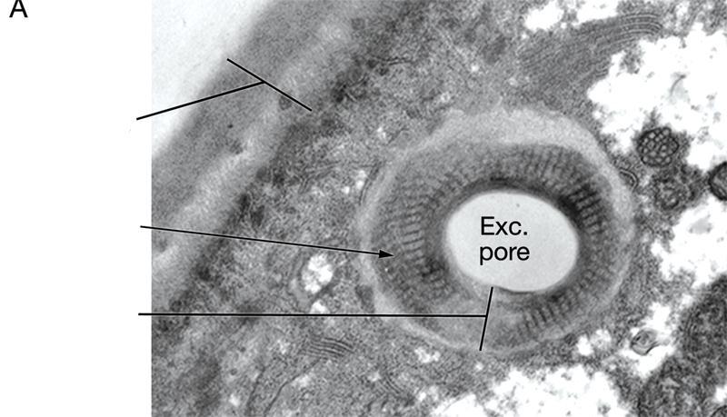 SISTEMA EXCRETOR CÉLULAS RENETE - PORO EXCRETOR