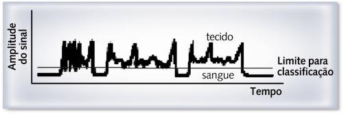 as bordas que correspondem à localização do endocárdio estão na interface sangue-tecido.