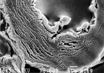 21 fibra: A figura 09 apresenta uma foto, ampliada pelo microscópio, da fibrilação interna da Figura 09. Foto de microscópio do efeito da fibrilação interna Fonte: (RODRIGUES, 1995, s.p.). 2.
