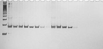 35 5.2 Limiar de detecção da Reação de Cadeia de Polimerase (PCR) com DNA de formas metacestóides de T. saginata e T.