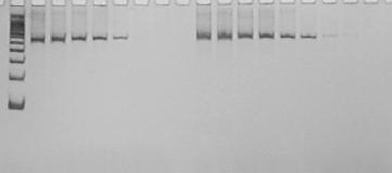 36 PM 1 2 3 4 5 6 7 8 1 2 3 4 5 6 7 8 NO 600 pb A B FIGURA 5: Produtos de amplificação de DNA, por PCR, de forma metacestóide de Taenia saginata (A) e Taenia solium (B), com a utilização de