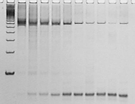 por PCR, de DNA de forma metacestóide de Taenia saginata com a utilização de oligonucleotídeos iniciadores F1R1 (HDP2), nas