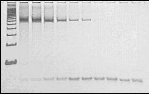 PM = padrão de peso molecular em escada de 100 pb (Invitrogen ); 1 = 22,66 ng de DNA de forma metacestóide de T.