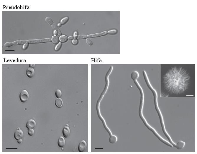 13 2 MICROBIOLOGIA A Candida pertence à classe Ascomycetes e à família Saccharomycetaceae, é um fungo diploide assexual e dimórfico, ou seja, dependendo das condições ambientais pode existir como