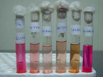 35 Figura 8 - Teste de fermentação de carboidratos positivo para Candida glabrata Fonte: GIRI, KINDO, 2015 Quadro 2 Chave de identificação das principais espécies de Candida de interesse médico.
