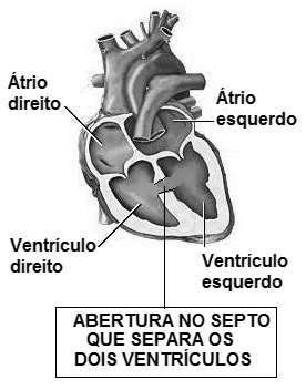 Explique por que essa alteração no coração pode levar esse bebê à morte, caso não seja corrigida o mais rápido possível. 07.