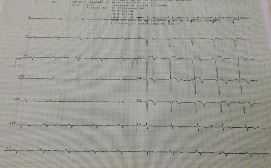 tabagismo de longa data (1/2 maço/dia), hipertensão arterial e angina há 3 anos.