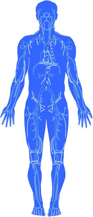 Manifestações Clínicas da Aterosclerose Cerebrais (derrames) Acidente Vascular