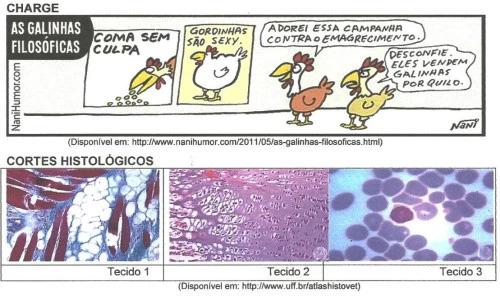 9. Observe a charge e os cortes histológicos a seguir: Assinale a alternativa que apresenta a correlação entre a imagem dos cortes histológicos e a descrição do tecido tratado na charge, responsável