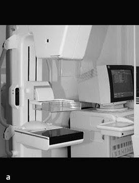 1Métodos Mamografia Digital Fig. 1.