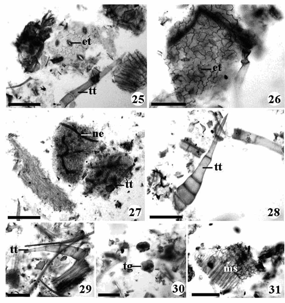 Estudo morfoanatômico preliminar do caule e da folha de Acanthospermum australe (Loefl.) Kuntze (Asteraceae-Heliantheae) Figuras 25-31.