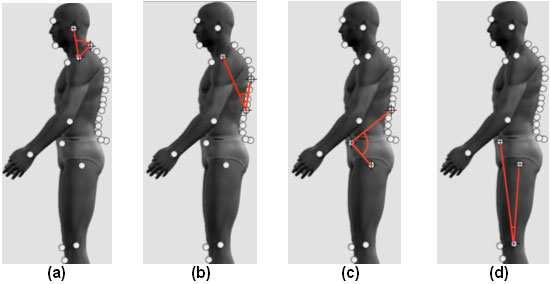 Postural qualitative analysis in mouth breath children 123 FIGURE 1 - Representation of the points and angles used in the postural evaluation, indicating (a) cervical lordosis; (b) thoracic kyphosis;