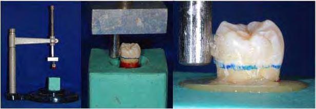 Figura 1 Seqüência para obtenção de camada uniforme de cera A seguir, os dentes foram posicionados com auxílio de delineador no interior de um molde de silicone (Silibor Clássico Artigos