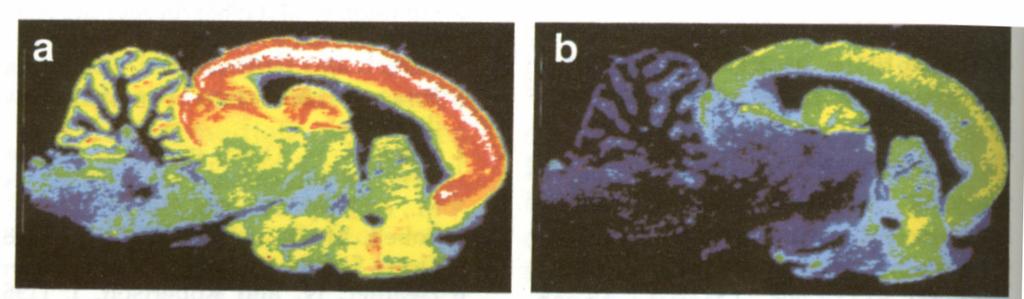 no SNC: α 1 β 2 γ 2 (Möhler et al.