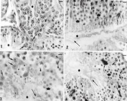 166 Figuras 1 4 - Fotomicrografias dos túbulos seminíferos do testículo de codorna da variedade italiana, nas estações de outono (1), inverno (2), primavera (3) e verão (4), sendo apontados a luz