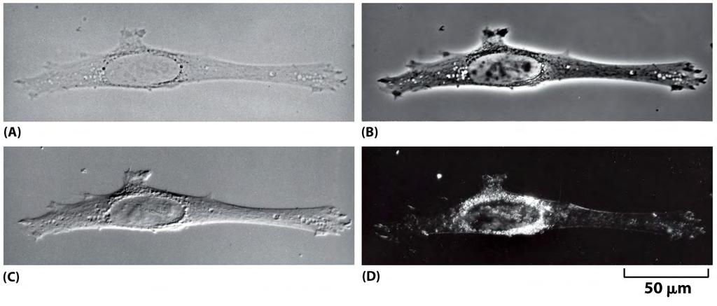 Observação direta de células em microscopia de luz (informação sobre a morfologia e dinâmica de