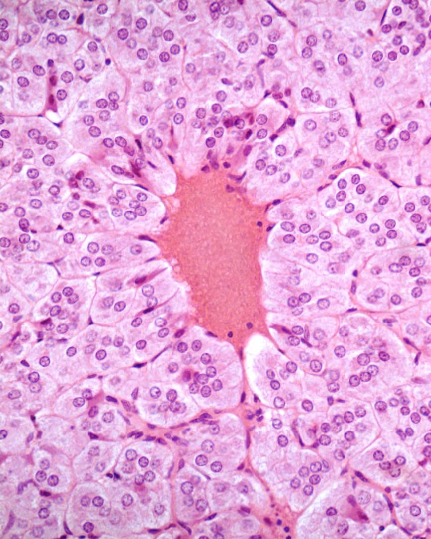 HISTOLOGIA Hematoxilina e eosina A combinação Hematoxilina e Eosina é a coloração mais usada em histologia e também em patologia para o diagnóstico de tumores