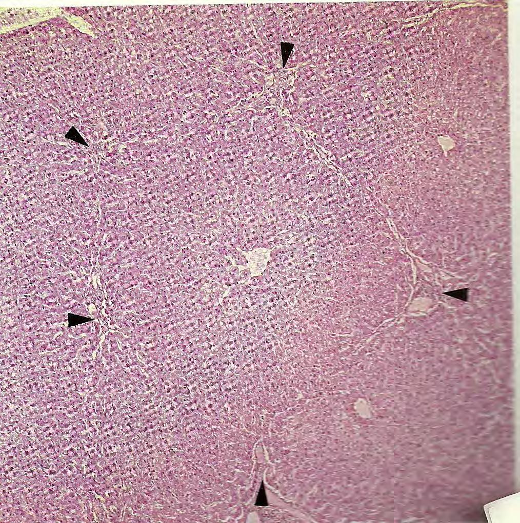 Disposição dos hepatócitos nos lóbulos