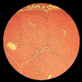 Mucosa, Submucosa, Muscular e Lóbulos hepáticos,