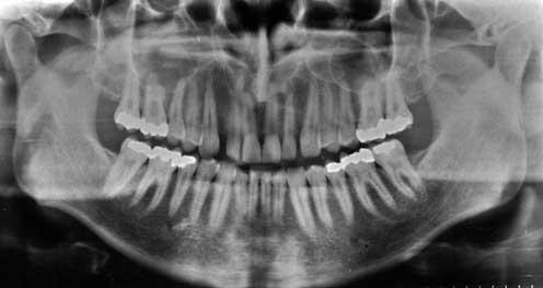 Material e Métodos 20 Figura 1 Radiografia