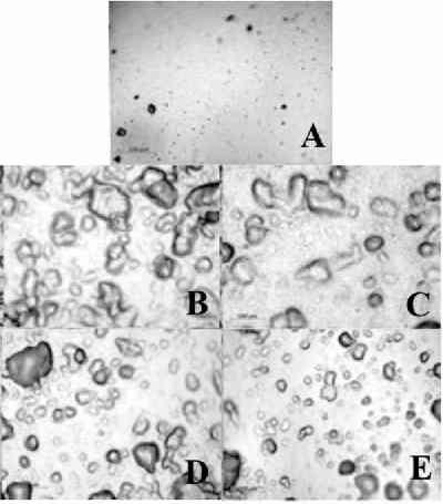 Materiais e métodos Os nanocompósitos foram preparadas nas concentrações de 1, 0,75, 0,5 e 0,25 % (p/v) de argila organofílica em quitosana 2 % (p/v) que foram dispensadas em placas de Petri de