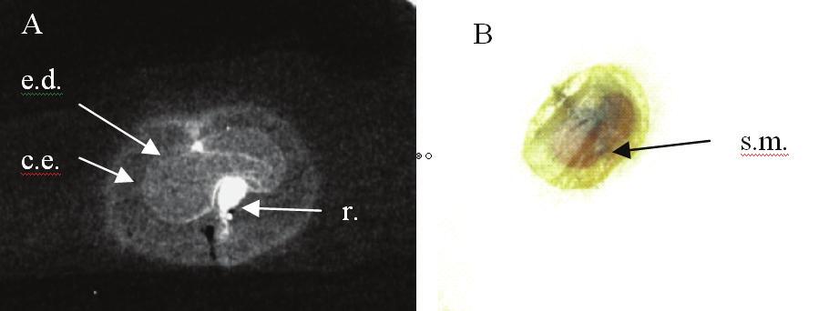 Pelo exame das imagens das sementes de Tecoma stans, foi observado que somente a classe 1 apresentou sementes sem embrião (SSE) (Tabela 2), como pode ser observado na radiografia de uma semente que