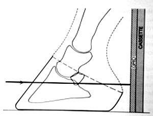 mesmas, para radiografia convencional ou digital.