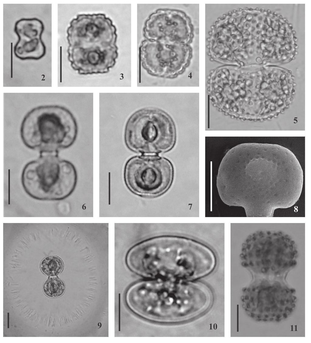 578 Hoehnea 37(3): 571-600, 8 fig., 2010 Figuras 2-11. Espécies de Cosmarium das APAs Lagoas de Guarajuba e Rio Capivara, Bahia, Brasil. 2. Cosmarium arctoum var. minor. 3-4. C. blyttii var. blyttii. 5. C. conspersum var.