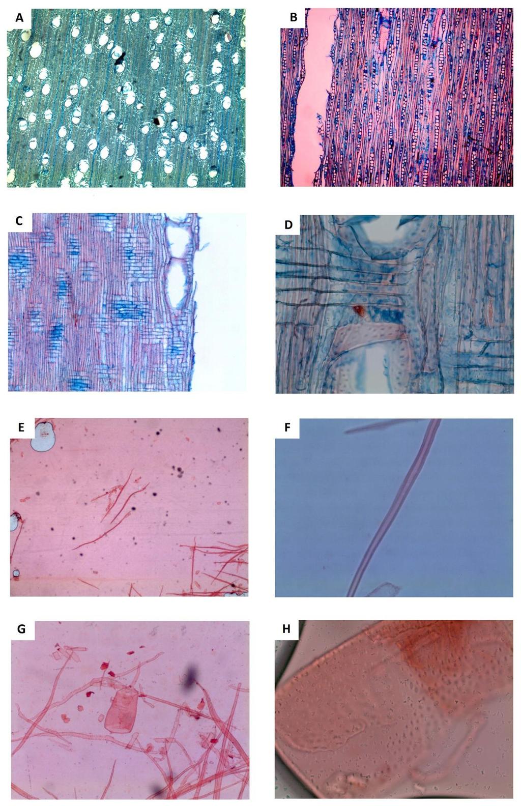 Figura 14: Fotomicrografias de Eucalyptus acervula Hook.