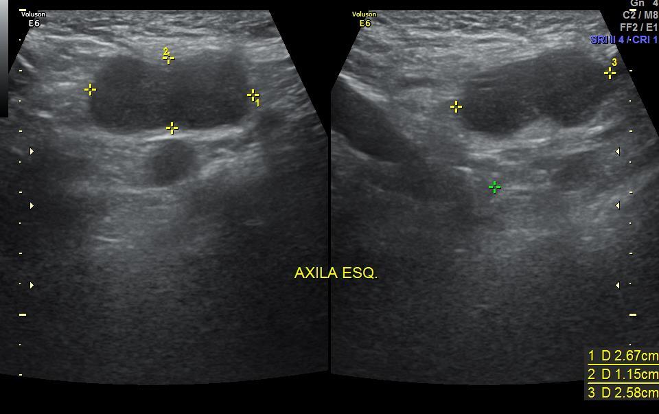 forma irregular, margens microlobuladas e