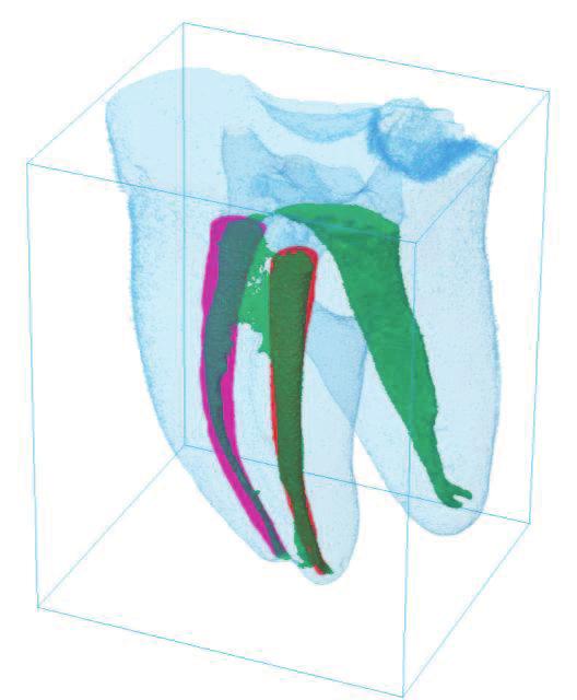Figura 9 - Dentes escaneados através
