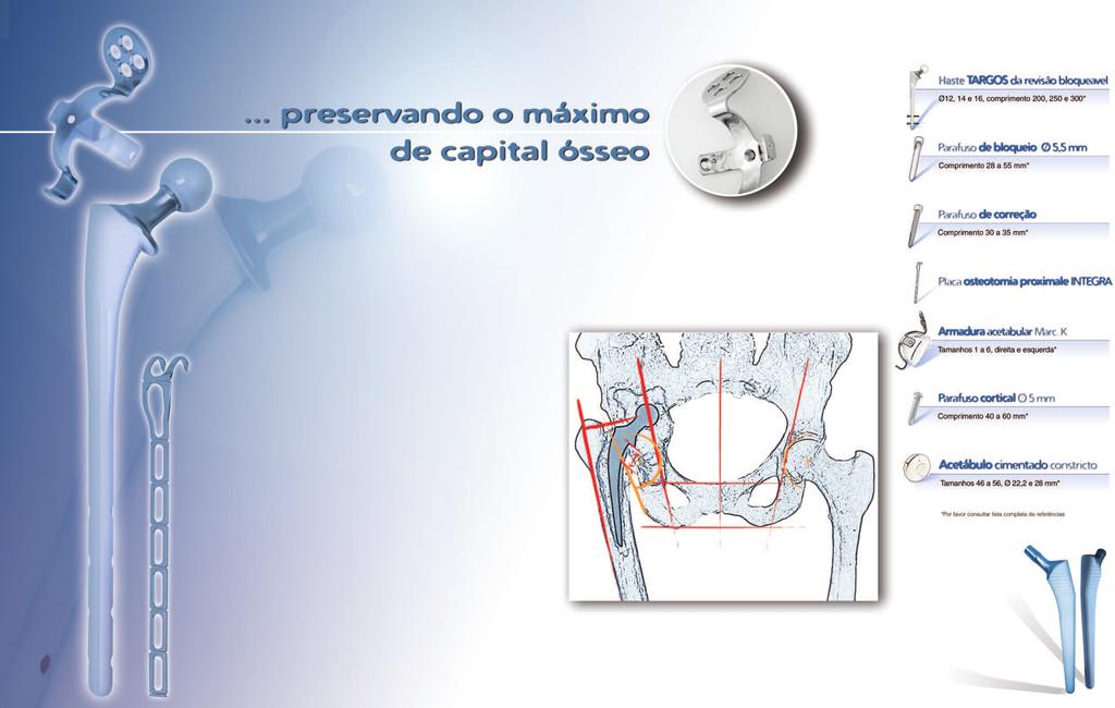 Anel de reforço e posicionamento metálico para reconstrução acetabular. Haste femoral recta para uma melhor integração óssea.