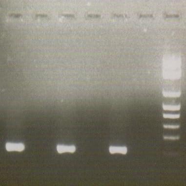 RESULTADOS Protocolos para a detecção e o diagnóstico de vírus Transmissão mecânica ELISA RT - PCR inconsistente para HiMV anti-soros comerciais: LSV, LMoV, ZaMV, DsMV primer HiMV específico