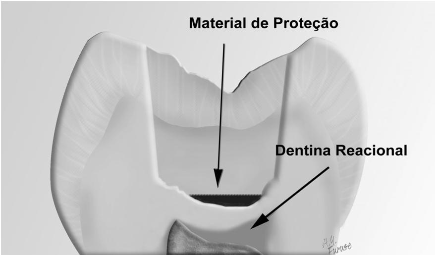 Cimento de Óxido de Zinco Indicações /