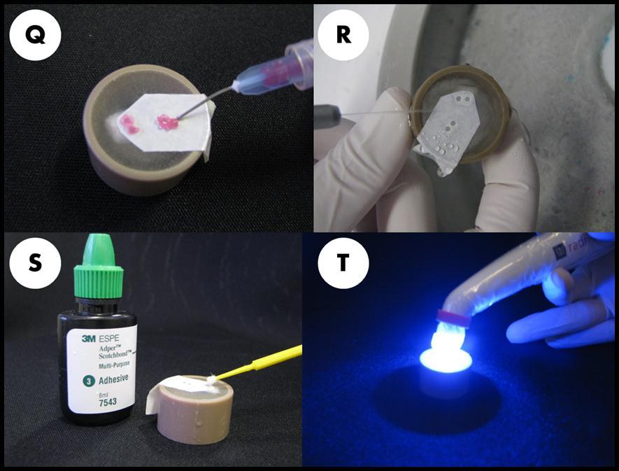 38 4.6 Procedimento adesivo Os espécimes foram condicionados com ácido fosfórico 37% (Condac 37, FGM Joinville, SC, Brasil)) durante 30 s (fig 5A), em seguida foram lavados abundantemente com água