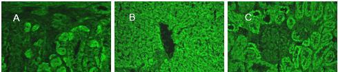 O padrão característico dos AMA no substrato triplo é revelada por uma fluorescência granular nas células parietais do estômago (A), no citoplasma dos hepatócitos (B) e nos túbulos distais e próximas