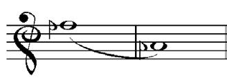 (A) 9ª maior, melódico, ascendente, consonante variável. (B) 7ª menor, melódico, ascendente, consonante invariável. (C) 6ª menor, melódico, ascendente, consonante variável.