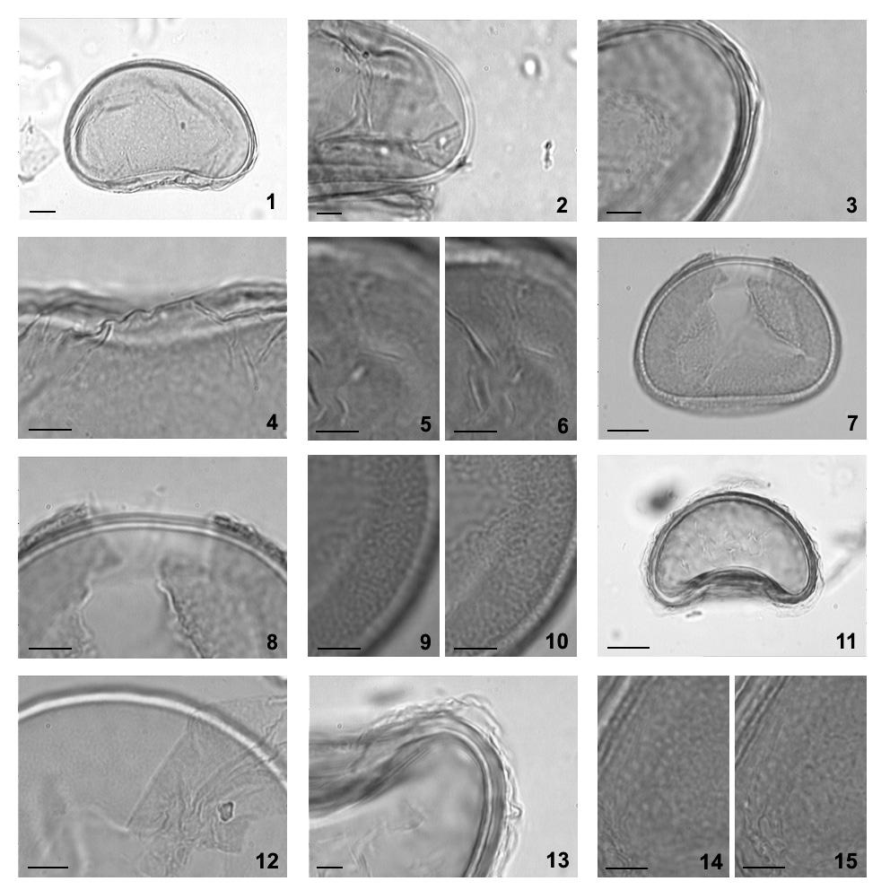 C.B. Coelho & L.M. Esteves: Morfologia de esporos de pteridófitas do PEFI: Blechnaceae. 389 Figuras 1-15. Fotomicrografias de esporos do gênero Blechnum L. (Blechnaceae). 1-6.