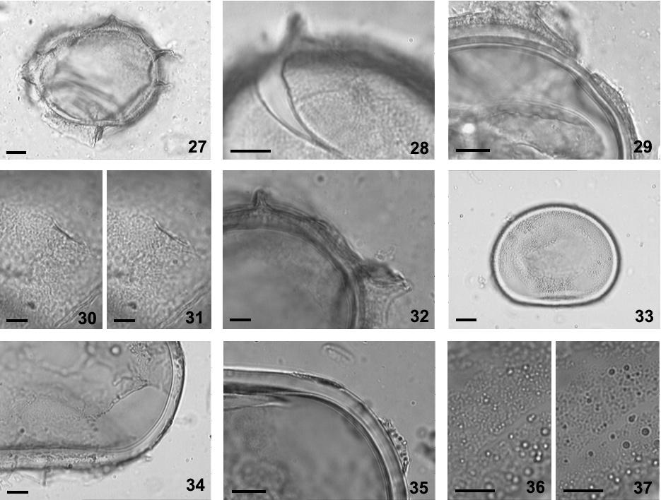 392 Hoehnea 35(3): 387-393, 37 fig., 2008 Figuras 27-37. Fotomicrografias de esporos dos gêneros Blechnum L. e Salpichlaena Hook. 27-32. Blechnum proliferum Rosenst. 27. Vista equatorial. 28.